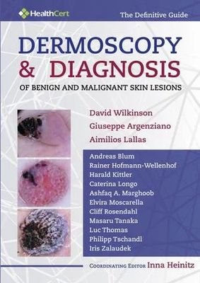 Dermoscopy And Diagnosis Of Benign And Malignant Skin Lesions