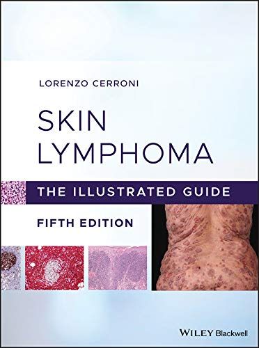 Skin Lymphoma: The Illustrated Guide, 5th Edition