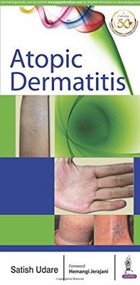 Atopic Dermatitis