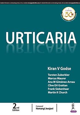 Urticaria, 2nd Edition