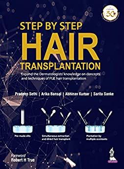 Step By Step Hair Transplantation
