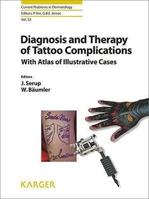 Diagnosis And Therapy Of Tattoo Complications: With Atlas Of Illustrative Cases (Current Problems In Dermatology, Vol. 52)