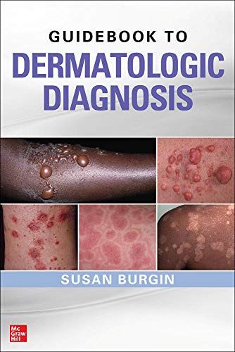 Guidebook To Dermatologic Diagnosis