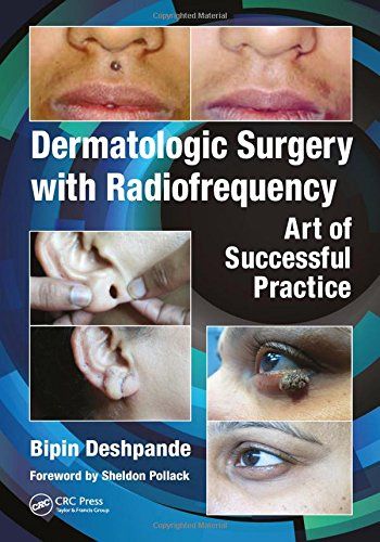 Dermatologic Surgery With Radiofrequency: Art Of Successful Practice