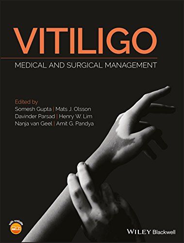 Vitiligo: Medical And Surgical ManagmementVitiligo: Medical And Surgical Managmement