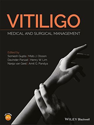 Vitiligo: Medical And Surgical ManagmementVitiligo: Medical And Surgical Managmement