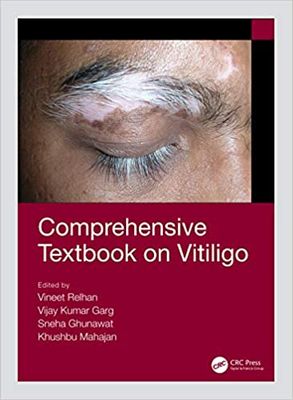 Comprehensive Textbook On Vitiligo