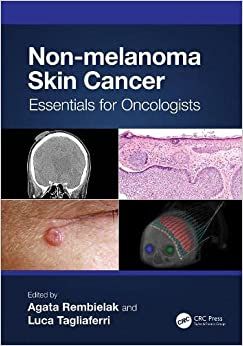 Non-Melanoma Skin Cancer: Essentials For Oncologists