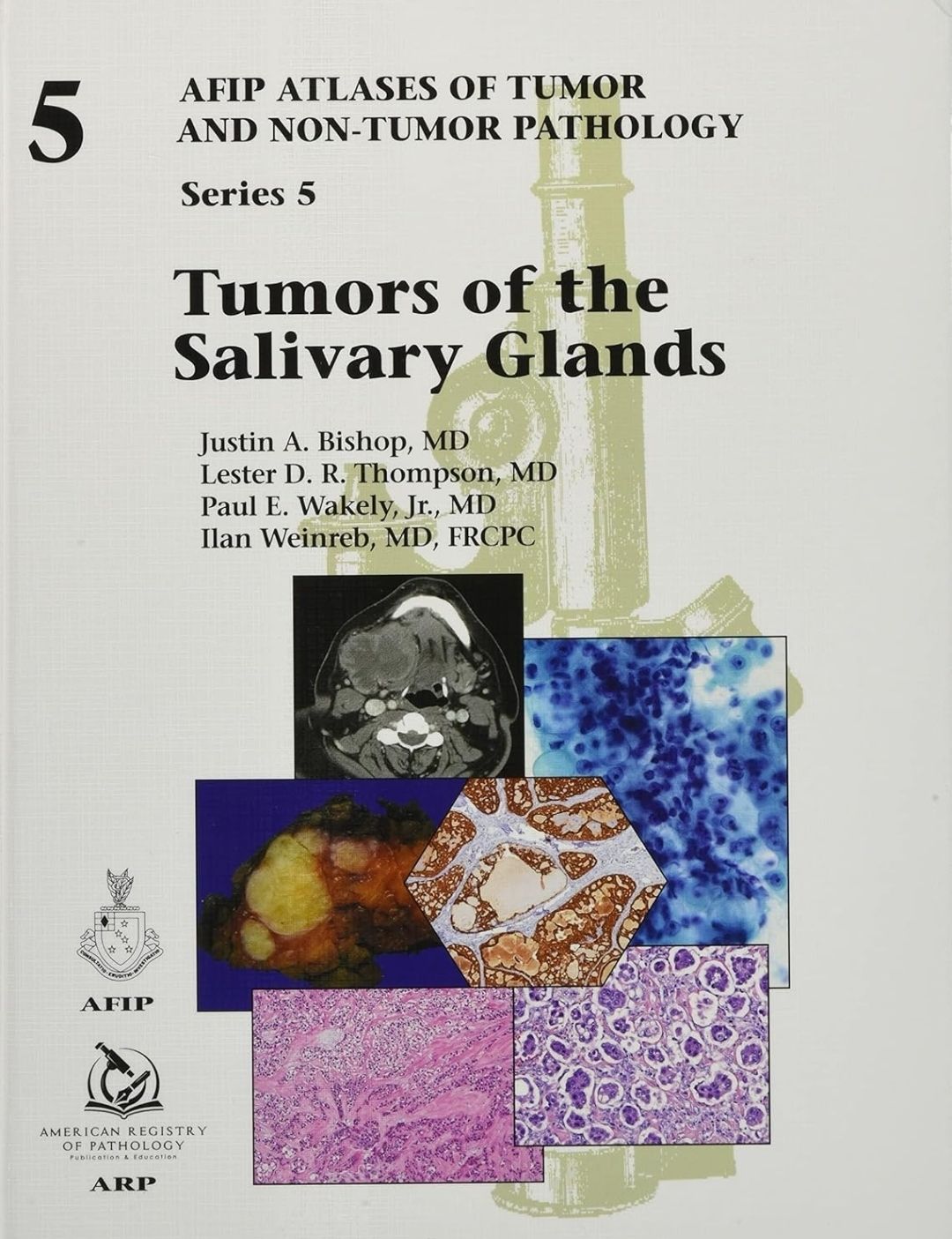 Tumors of the Salivary Glands AFIP Atlases of Tumors and Non-Tumors Pathology Series 5 Volume 2 American Registry of Pathology