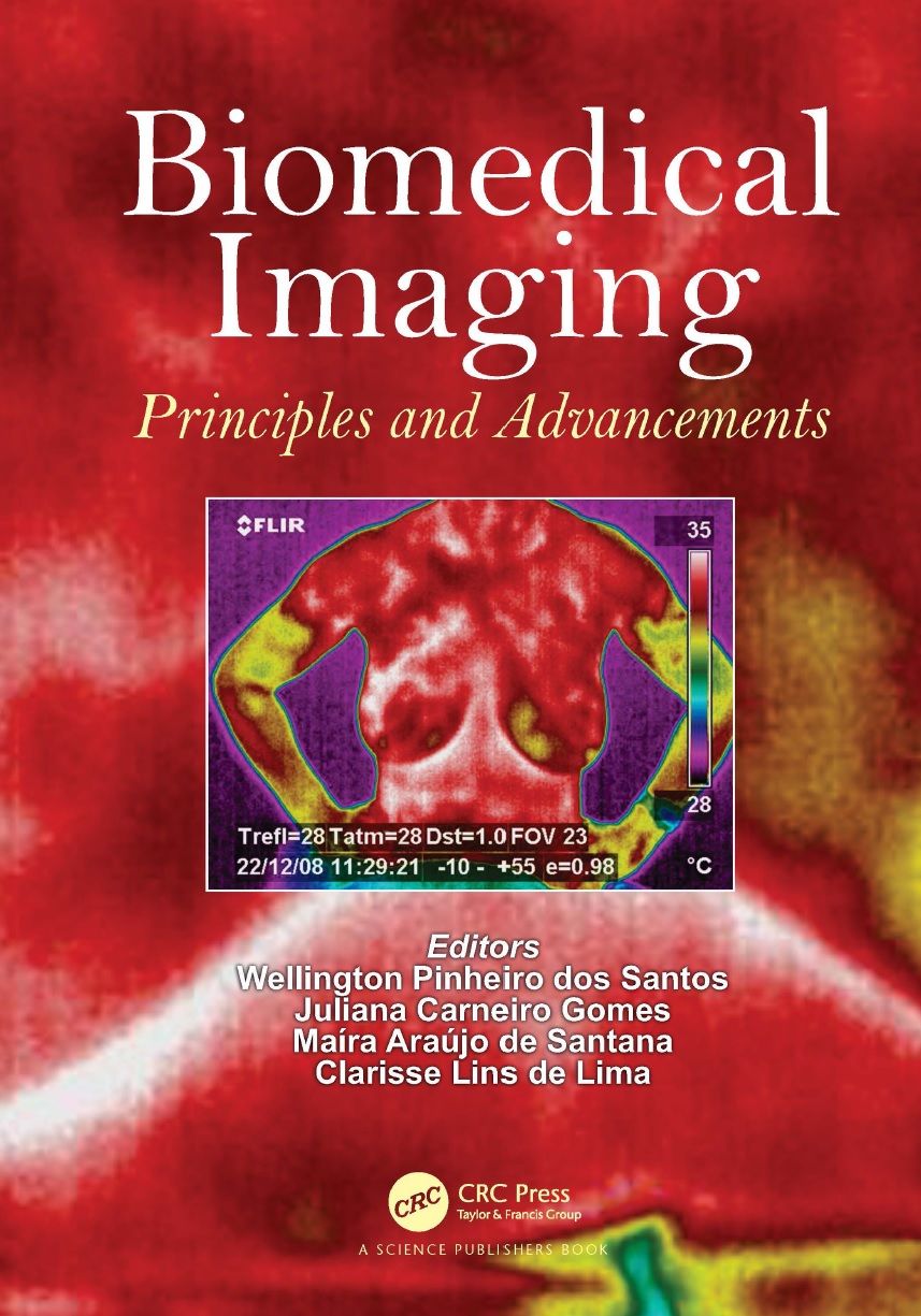 Biomedical Imaging: Principles And Advancements