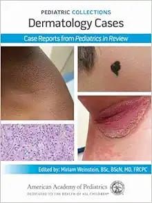 Pediatric Collections: Dermatology Cases: Case Reports From Pediatrics In Review