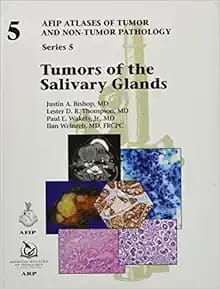 Tumors Of The Salivary Glands: Series 5