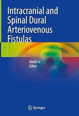 Intracranial And Spinal Dural Arteriovenous Fistulas
