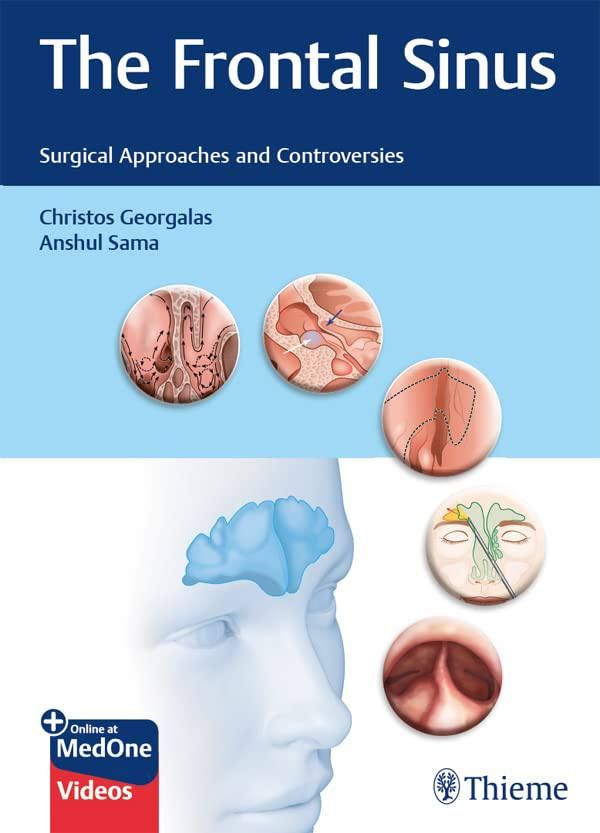 The Frontal Sinus: Surgical Approaches And Controversies
