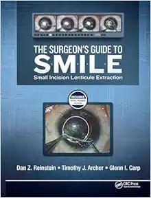 The Surgeon’s Guide to SMILE: Small Incision Lenticule Extraction