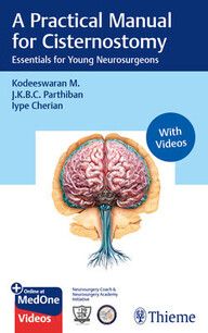 Iype Cherian A Practical Manual For Cisternostomy: Essentials for Young Neurosurgeons