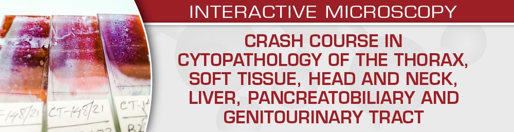 Crash Course in Cytopathology: Thorax, Soft Tissue, Head and Neck, Liver, Pancreatobiliary and Genitourinary Tract – USCAP