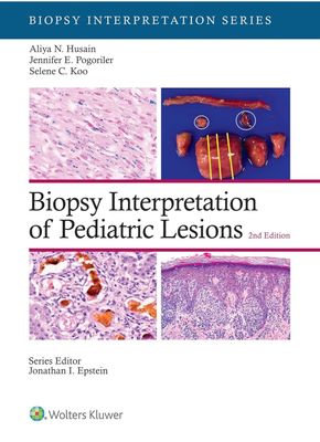 Biopsy Interpretation of Pediatric Lesions, Second Edition