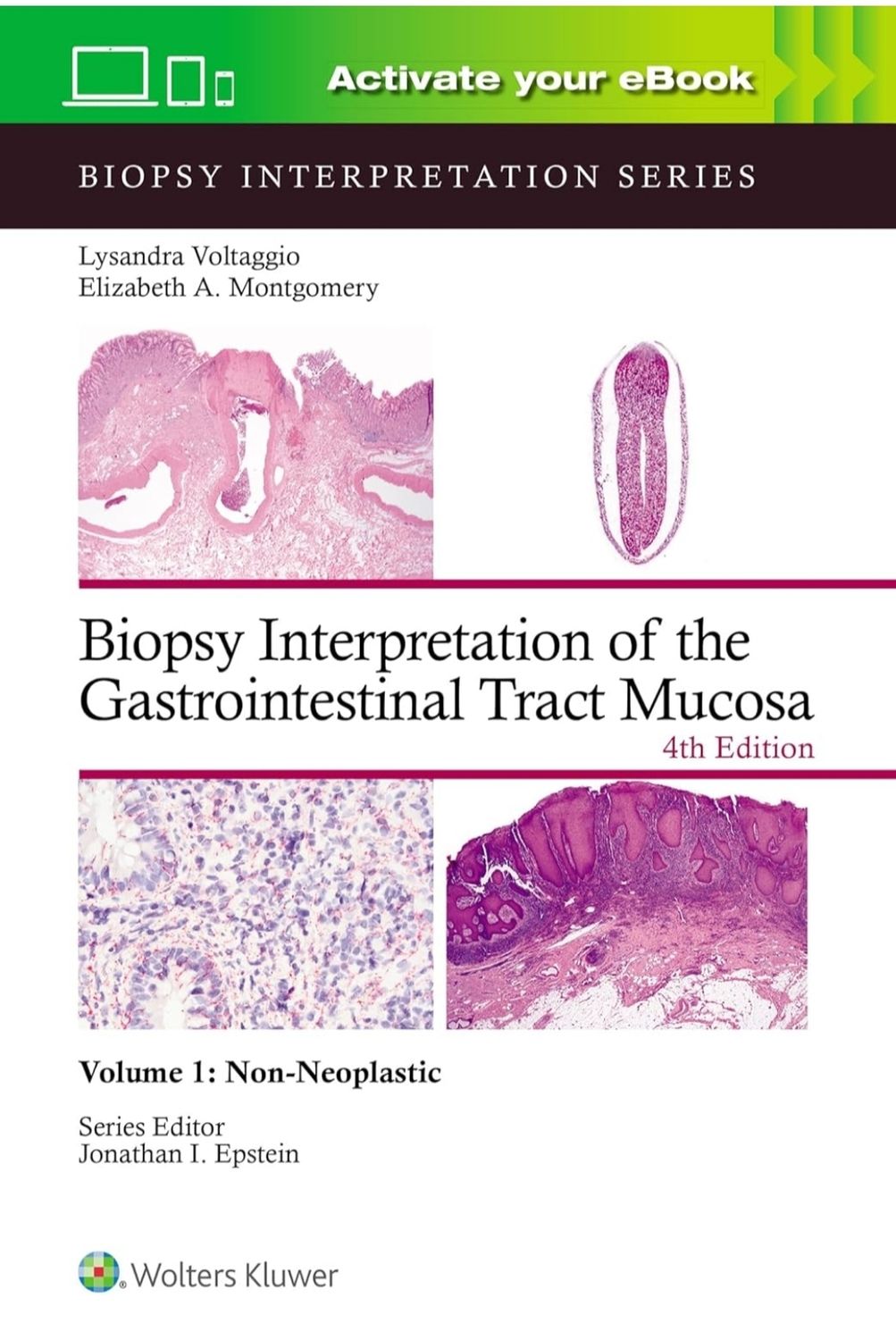 Biopsy Interpretation of the Gastrointestinal Tract Mucosa Volume 1: Non-Neoplastic, 4ed 2024