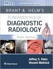 Fundamentals of Diagnostic Radiology