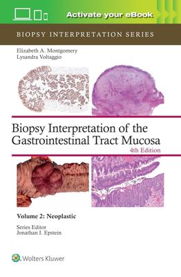 Biopsy Interpretation of the Gastrointestinal Tract Mucosa Volume 2: Neoplastic (Biopsy Interpretation Series) 2024