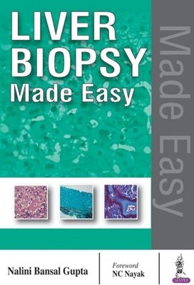 Liver Biopsy Made Easy