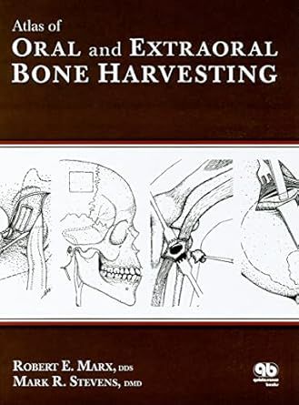 Atlas Of Oral And Extraoral Bone Harvesting