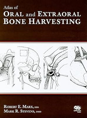 Atlas Of Oral And Extraoral Bone Harvesting