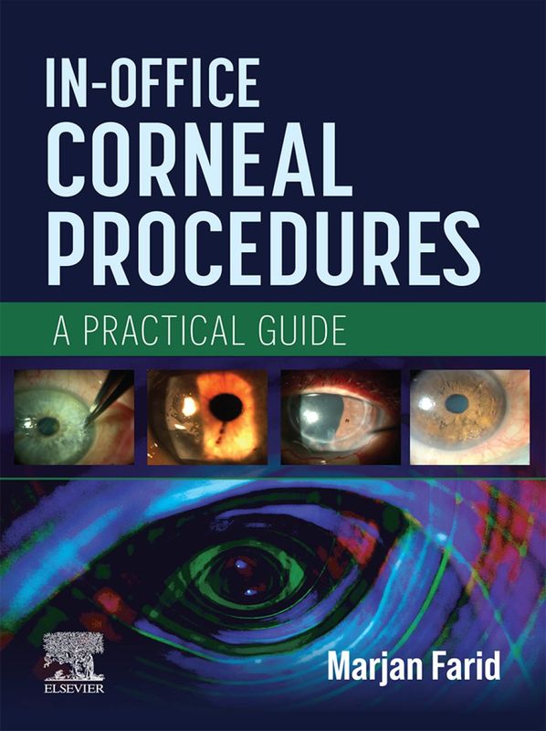 In-Office Corneal Procedures: A Practical Guide