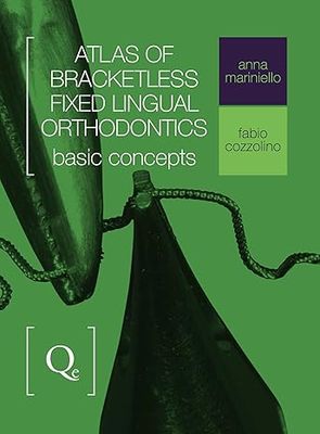 Atlas of Bracketless Fixed Lingual Orthodontics: Basic Concepts
