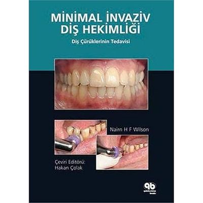 Minimally Invasive Dentistry: The Management of Caries