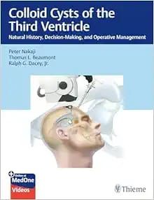Colloid Cysts of the Third Ventricle: Natural History, Decision-Making