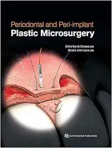 Periodontal and Peri-implant Plastic Microsurgery: Minimally Invasive Techniques with Maximum Precision