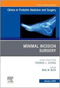 Minimal Incision Surgery, An issue of Clinics in Podiatric Medicine and Surgery (The Clinics: Orthopedics, Volume 42-1) (True PDF from Publisher)