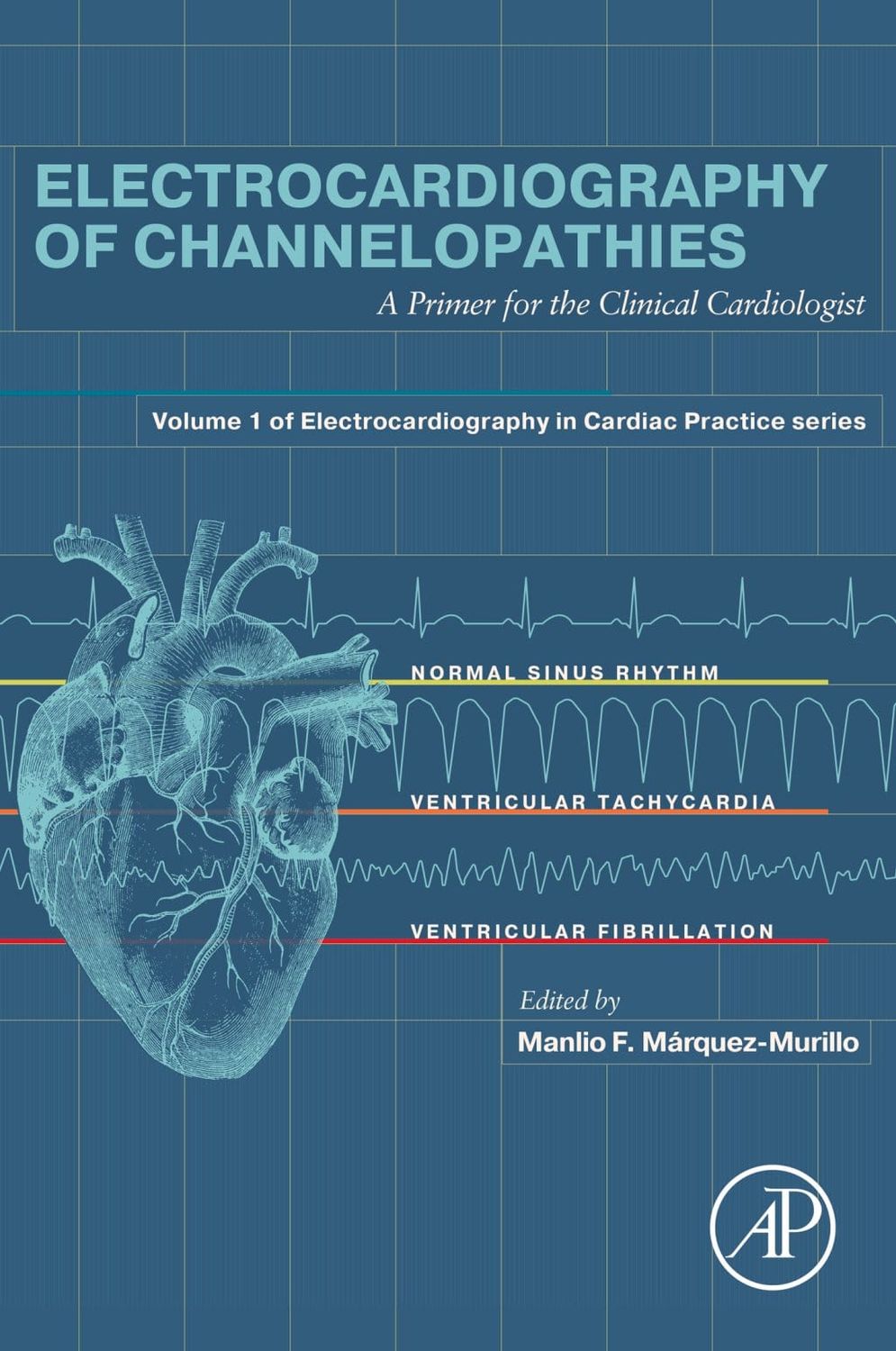 Electrocardiography of Channelopathies: A Primer for the Clinical Cardiologist (True PDF from Publisher)