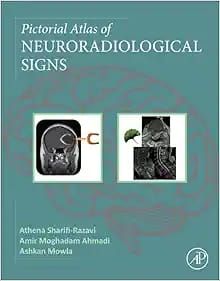 Pictorial Atlas of NEURORADIOLOGICAL SIGNS