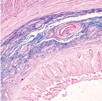 Oakstone Gastropathology 2024 (Videos + Slides)