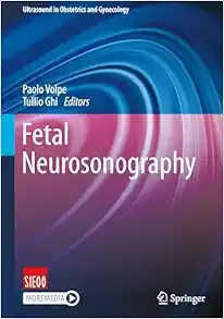 Fetal Neurosonography (Ultrasound in Obstetrics and Gynecology)