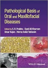 Pathological Basis of Oral and Maxillofacial Diseases