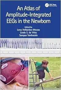 An Atlas of Amplitude-Integrated EEGs in the Newborn