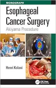 Esophageal Cancer Surgery