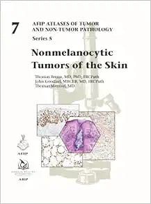 Nonmelanocytic Tumors of the Skin (AFIP Atlas of Tumor and Non-Tumor Pathology, Series 5, Fascicle 7) (Original PDF from Publisher)