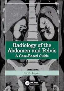 Radiology of the Abdomen and Pelvis: A Case-Based Guide, 1st Edition