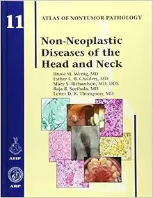 Non-Neoplastic Diseases of the Head and Neck (Atlas of Nontumor Pathology, Series 1, Number 11)