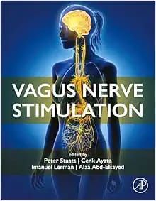 VAGUS NERVE STIMULATION