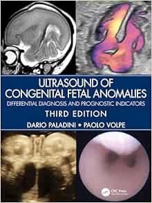 Ultrasound of Congenital Fetal Anomalies: Differential Diagnosis and Prognostic Indicators, 3rd Edition