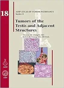 Tumors of the Testis and Adjacent Structures (AFIP Atlas of Tumor Pathology, Series 4, Fascicle 18) (Original PDF from Publisher)