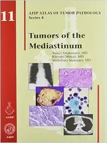 Tumors of the Mediastinum (AFIP Atlas of Tumor Pathology, Series 4, Fascicle 11) (Original PDF from Publisher)