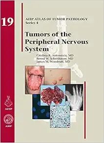 Tumors of the Peripheral Nervous System (AFIP Atlas of Tumor Pathology, Series 4, Fascicle 19) (Original PDF from Publisher)