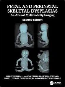 Fetal and Perinatal Skeletal Dysplasias